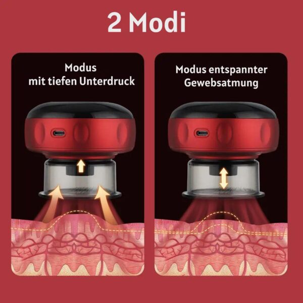 Elektrisches Massageschröpfgerät "FasziaTherma" 5-in-One Konzept für ein ganzheitliche, effektive Faszien-, Cellulite-, Lymphdrainage & Rotlichttherapie – Bild 4